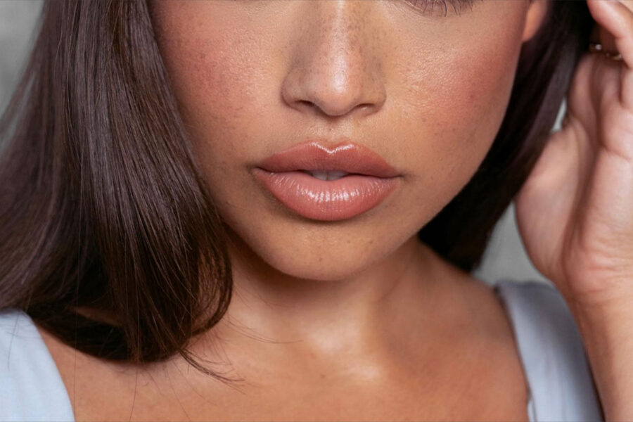 Restylane Variant Restylane in Medford, OR | Advanced Health & Wellness